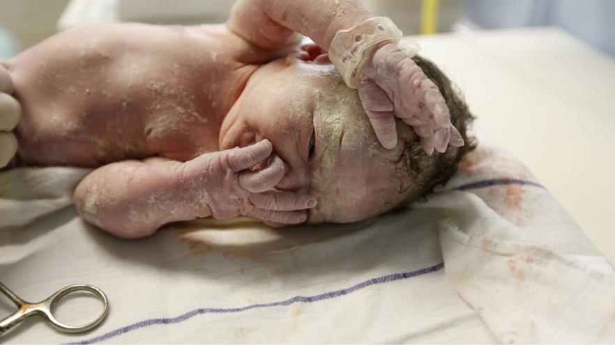 newborn baby covered in vernix
