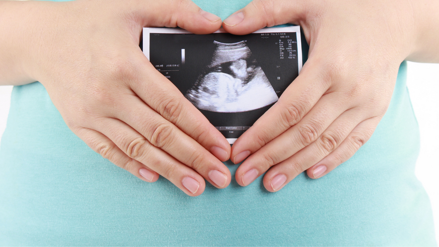 Ultrasound 